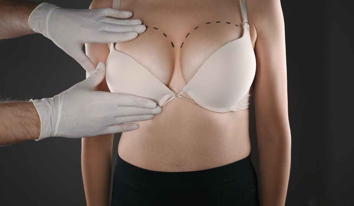 عملية رفع الثدي وشد الصدر