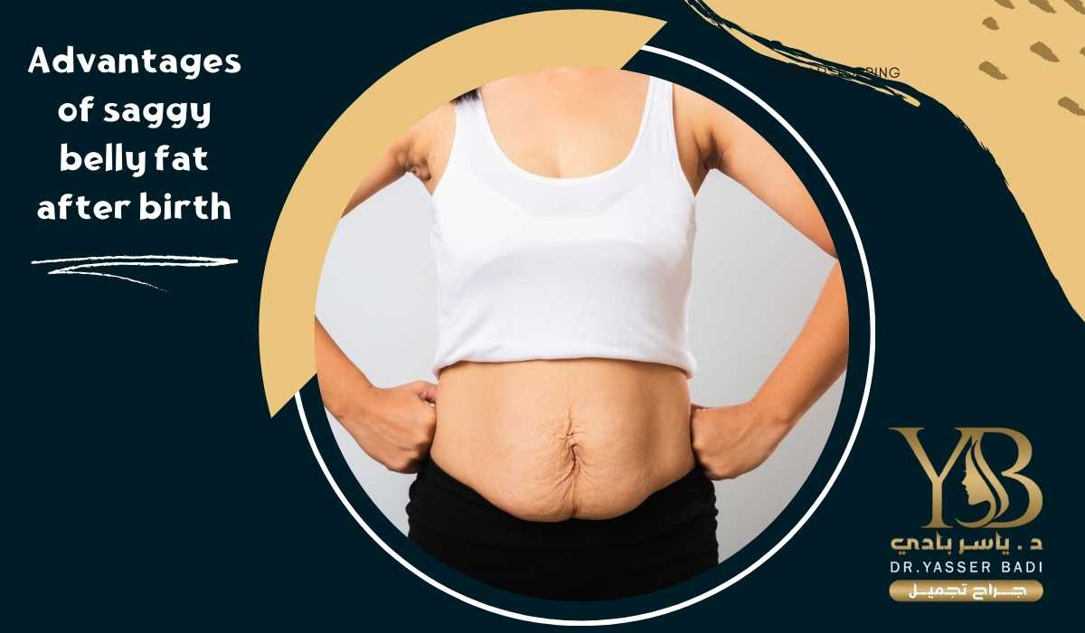 Advantages of saggy belly fat after birth