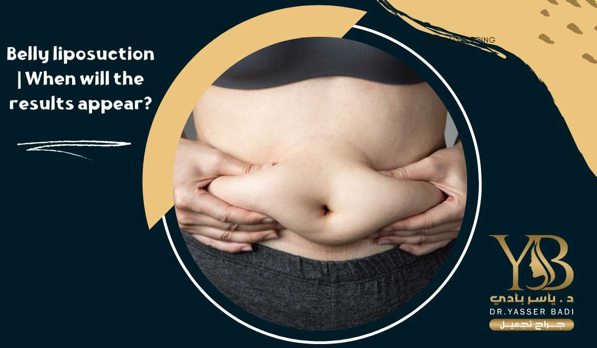The results of belly liposuction