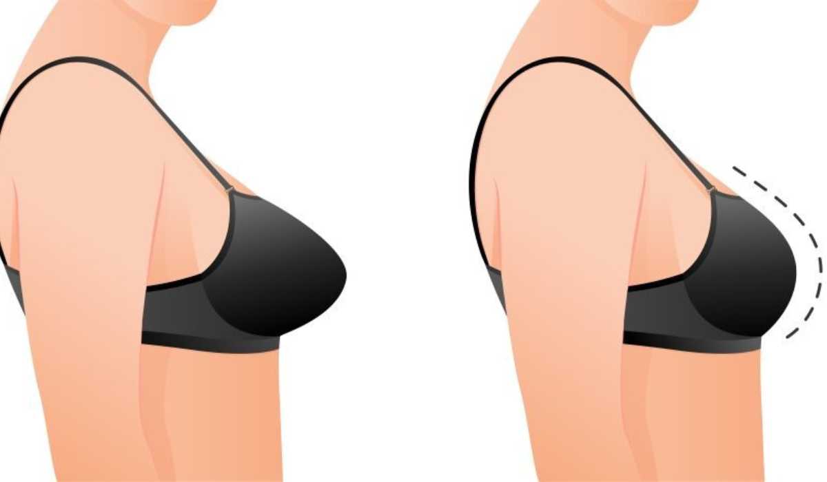 Best plastic surgeon for breast surgery