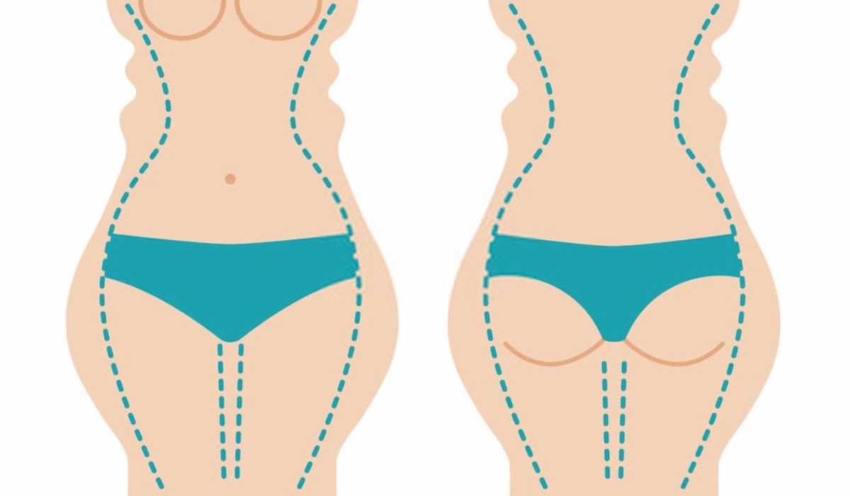 What is Body contouring